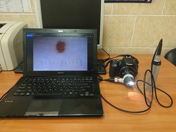 Прибор для цифровой дерматоскопии
